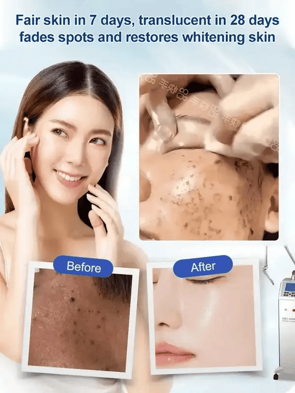 Korean Vitamin E Urea Cream 100g (BUY 1 GET 1 FREE 🔥)